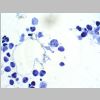 Medula osea SF 15.jpg